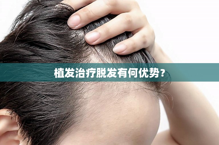 植发治疗脱发有何优势？