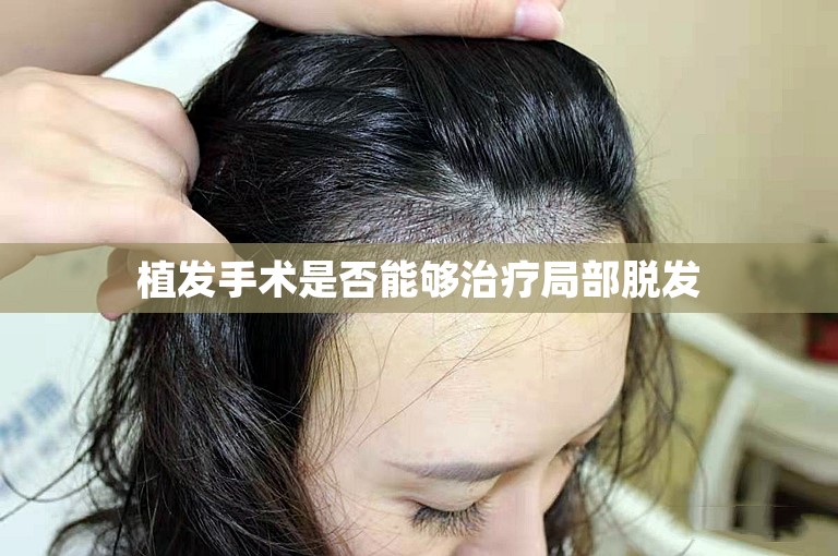 植发手术是否能够治疗局部脱发