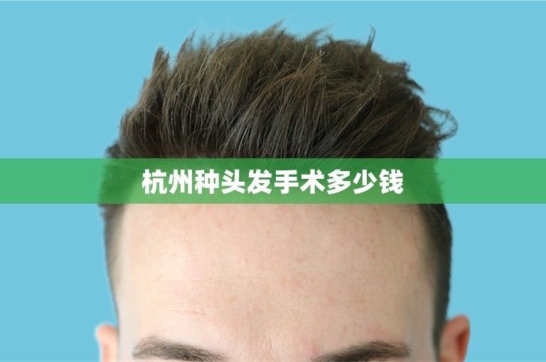 杭州种头发手术多少钱