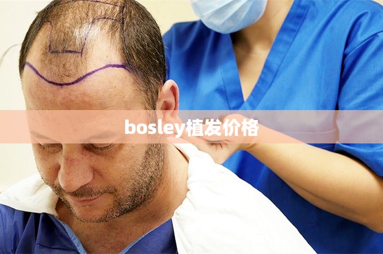 bosley植发价格