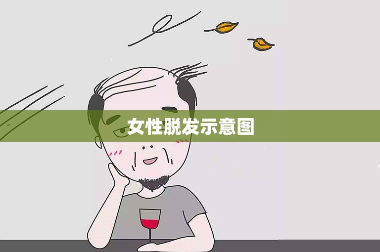 女性脱发示意图