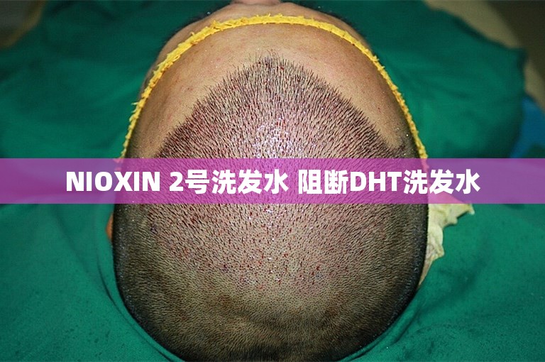 NIOXIN 2号洗发水 阻断DHT洗发水