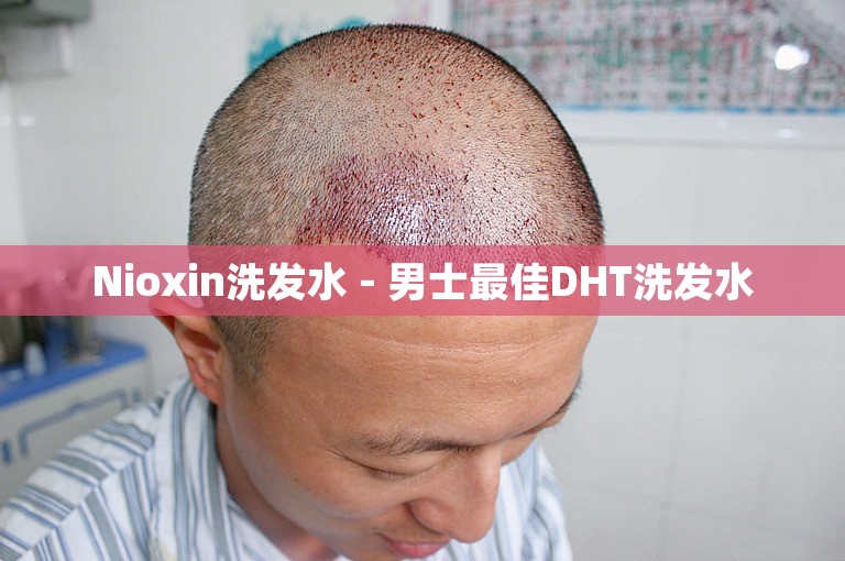 Nioxin洗发水 - 男士最佳DHT洗发水