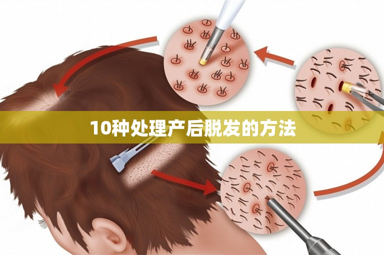 10种处理产后脱发的方法