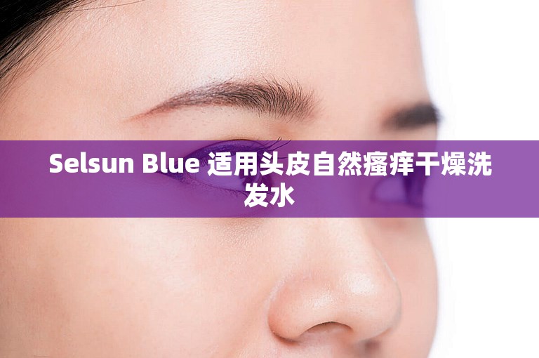 Selsun Blue 适用头皮自然瘙痒干燥洗发水