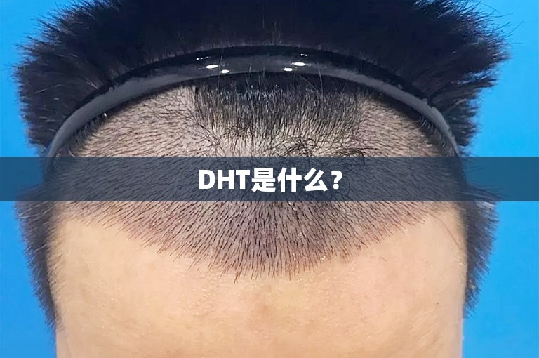 DHT是什么？