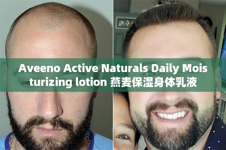 Aveeno Active Naturals Daily Moisturizing lotion 燕麦保湿身体乳液