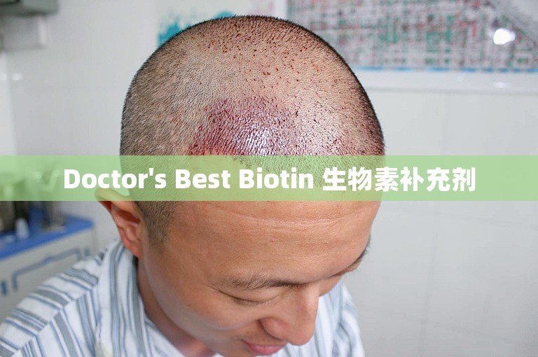 Doctor's Best Biotin 生物素补充剂