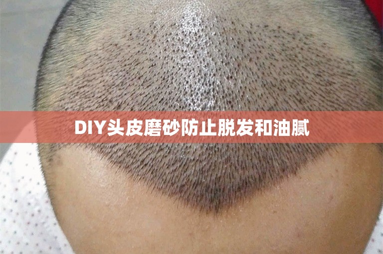 DIY头皮磨砂防止脱发和油腻