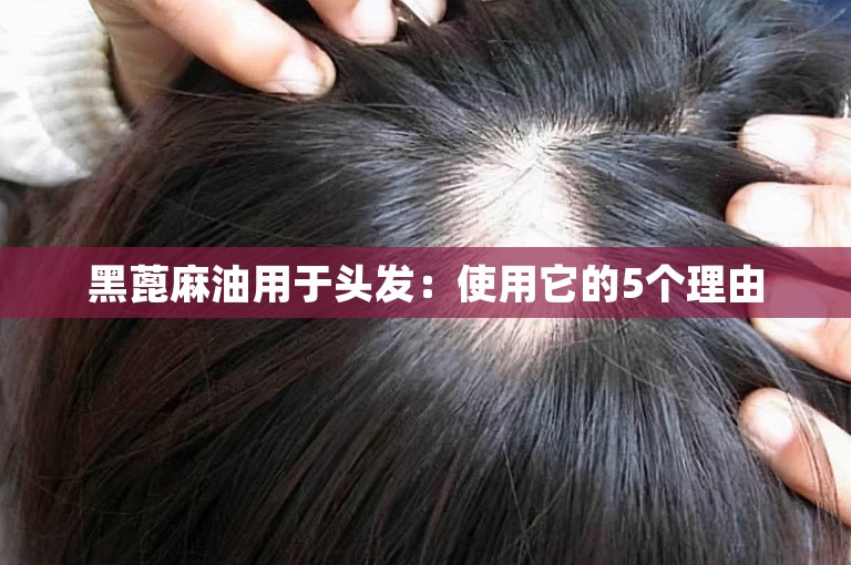 黑蓖麻油用于头发：使用它的5个理由