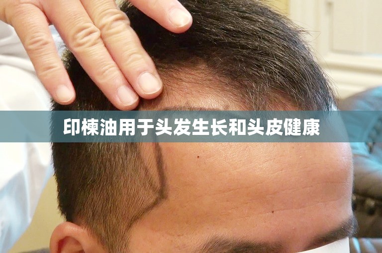 印楝油用于头发生长和头皮健康