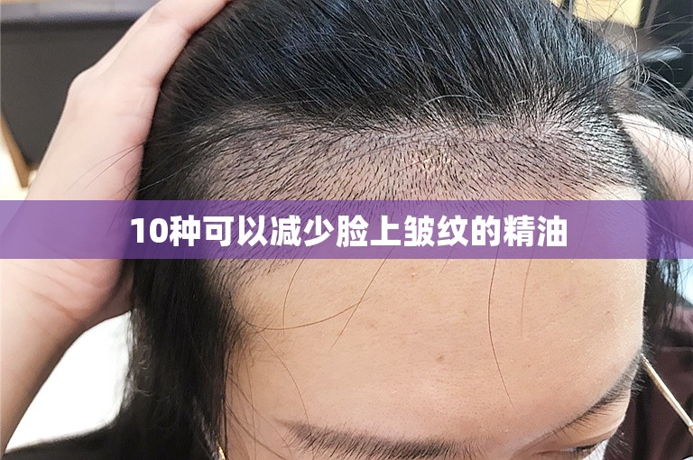 10种可以减少脸上皱纹的精油