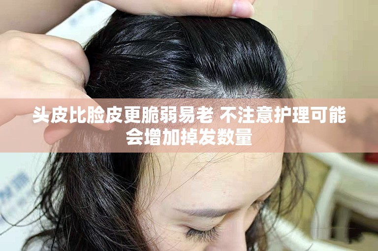 头皮比脸皮更脆弱易老 不注意护理可能会增加掉发数量