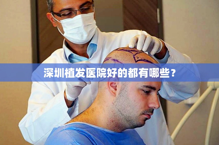 深圳植发医院好的都有哪些？
