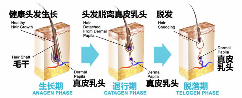 【图】头发生长周期三阶段