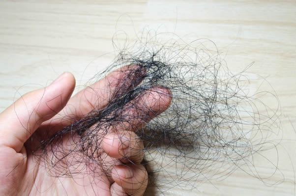 【组图】抑制DHT洗发水真的可以对抗脱发吗？