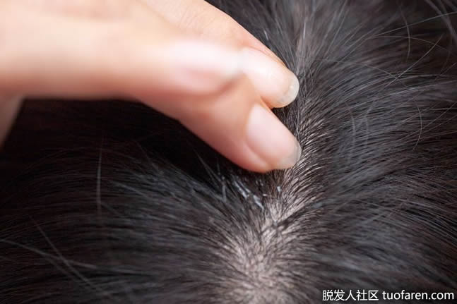 【组图】如何使用橄榄油作为热油治疗头发？