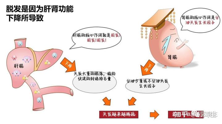 秋季脱发高峰，真的很秃然，别怕，试试芸海生自然生发液