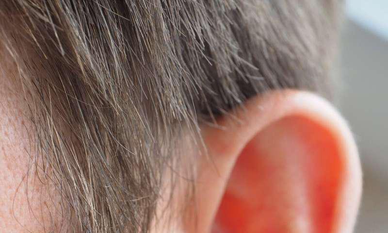 掉头发调节基因表达的小分子microRNA可促进毛发再生