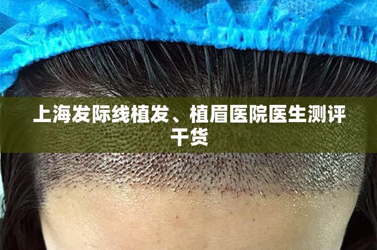 上海发际线植发、植眉医院医生测评干货