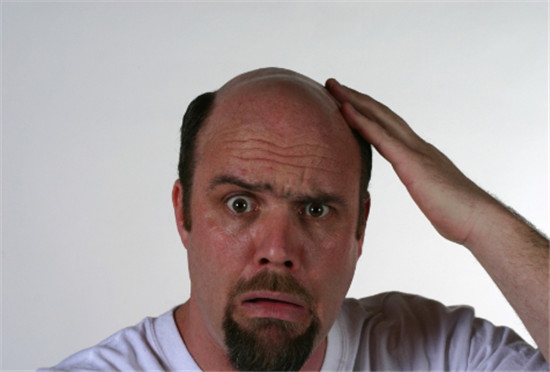 秃顶植发副作用，秃顶植发的危害