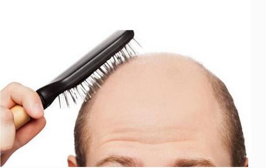 关于脱发的治疗药物和植发哪个效果更好？