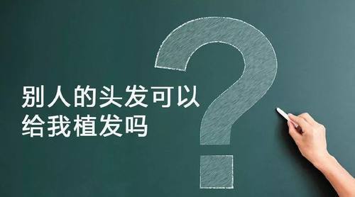 自己毛囊资源不够用别人的头发可以植发吗？