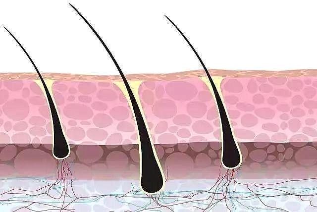 毛囊检测的作用是什么？