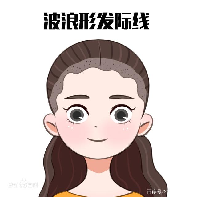 韩国植发：毛杰琳女性自然发际线重点在于“小碎发”