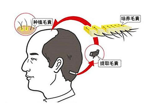 植发前做检测有什么用吗？