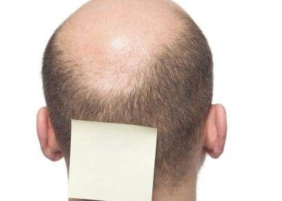 男性植发真的会影响生育吗？