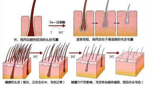 广州植发会损伤脑部神经吗？