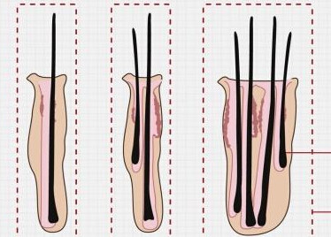 毛囊的两个小常识解析