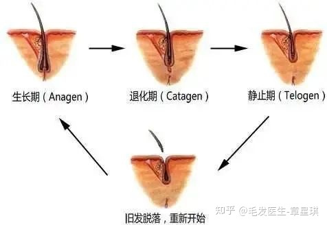 植发最终效果如何？这些因素决定