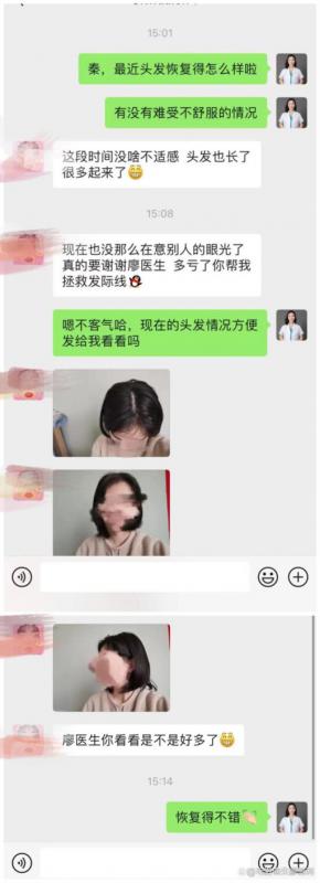 为什么秃顶的人这么多却很少有植发的？