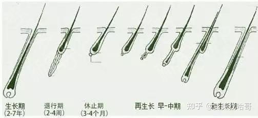 这几种人想要植发注意了，不然白做了！