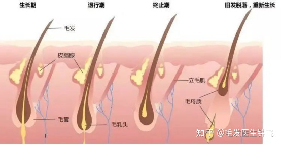 植发后头发又掉了！是植发失败了吗？