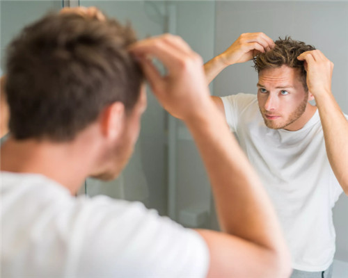 脱发完全是男性的问题吗