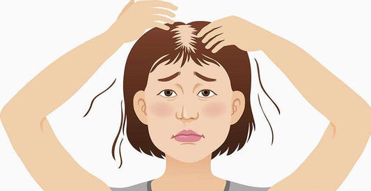 女性脱发小知识：是什么原因导致女性脱发的呢？