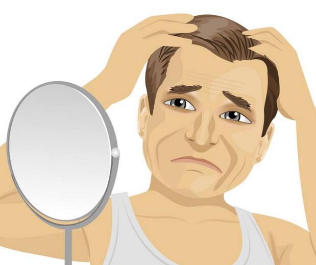 脱发为何常常发生在男性身上