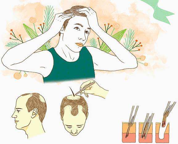 日常生活中有哪些预防脱发的方法