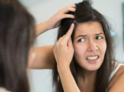 头皮发炎脱发应该要怎么办呢