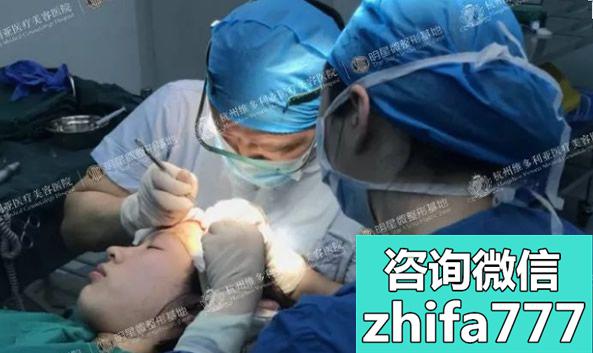 在杭州维多利亚花29500元做了植发手术，半个月就看到了效果