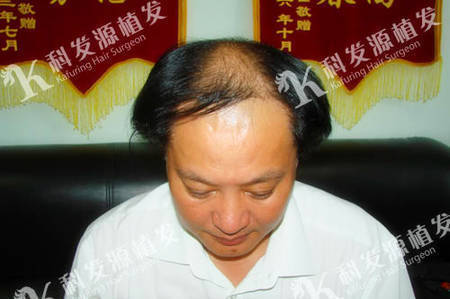 毛主席特性演员刘植发两年半后换新貌