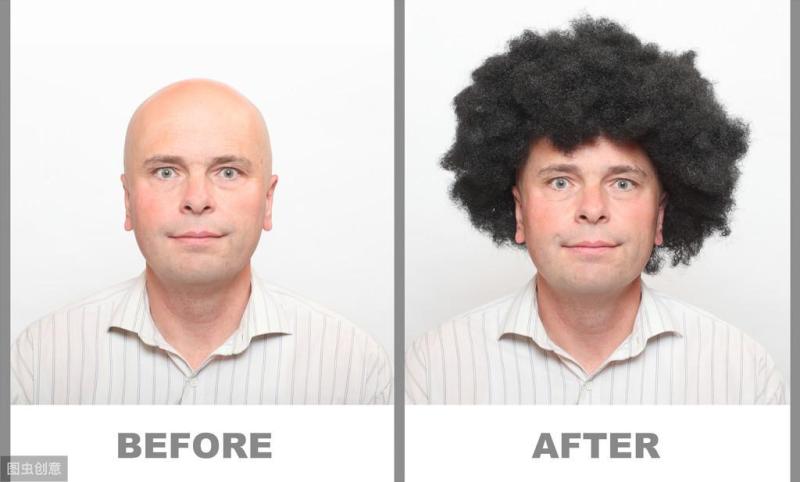 植发后的效果能保持多久？